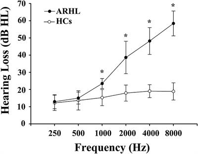 Disrupted Topological Organization of Resting-State Functional Brain Networks in Age-Related Hearing Loss